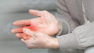 류마티스 관절염