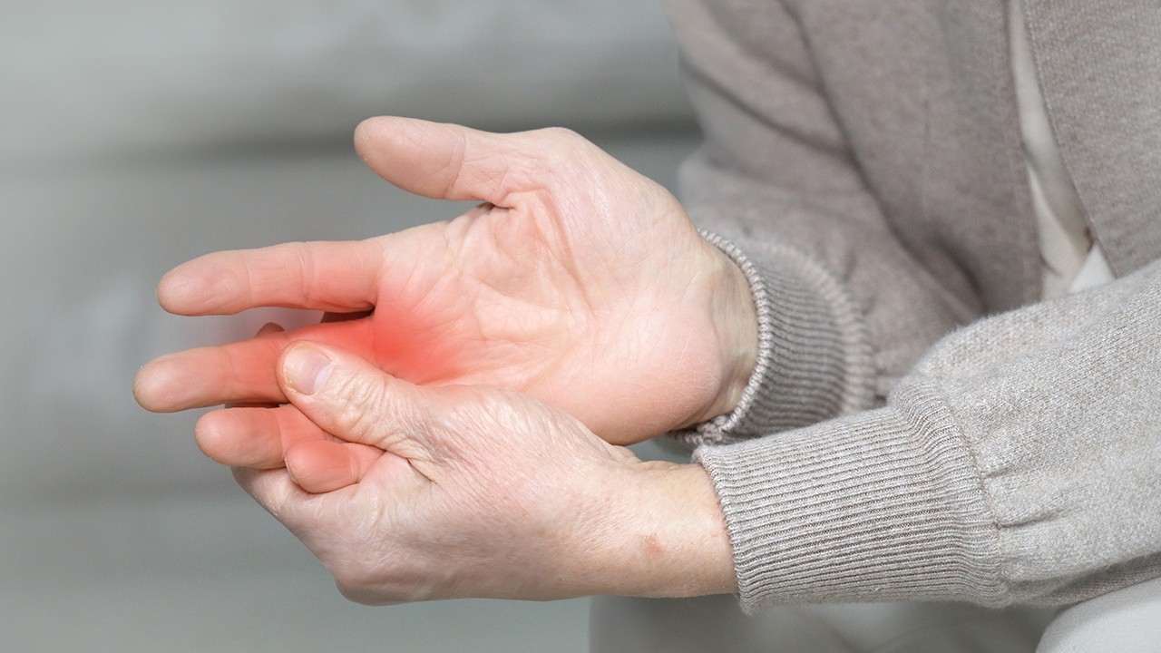 류마티스 관절염