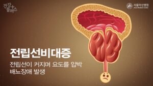 전립선비대증