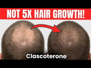 클라스코테론(Clascoterone)