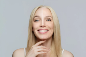 태반크림-플라센트렉스 겔(placentrex gel)