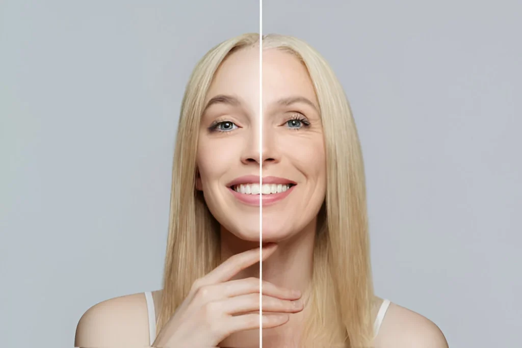 태반크림-플라센트렉스 겔(placentrex gel)