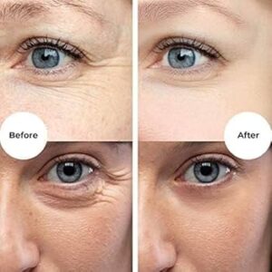 피부 노화와 손상된 장벽을 회복시키려는 노력은 현대 미용 의학의 핵심 과제입니다. 그중에서도 이른바 '태반 연고'로 불리는 플라센트렉스 겔(placentrex gel)은 독특한 성분 구성과 강력한 재생력으로 주목받고 있습니다. 단순한 화장품을 넘어 의약품 수준의 치유력을 가진 이 제품의 효능을 과학적 관점에서 분석해 봅니다.